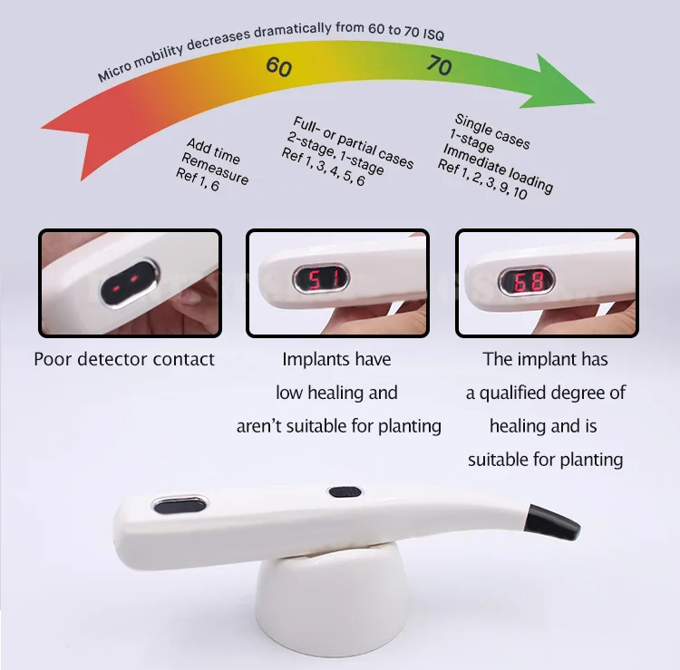 Denta Implant Stability Tester Implant Osseointegration Monitor ISQ Meter